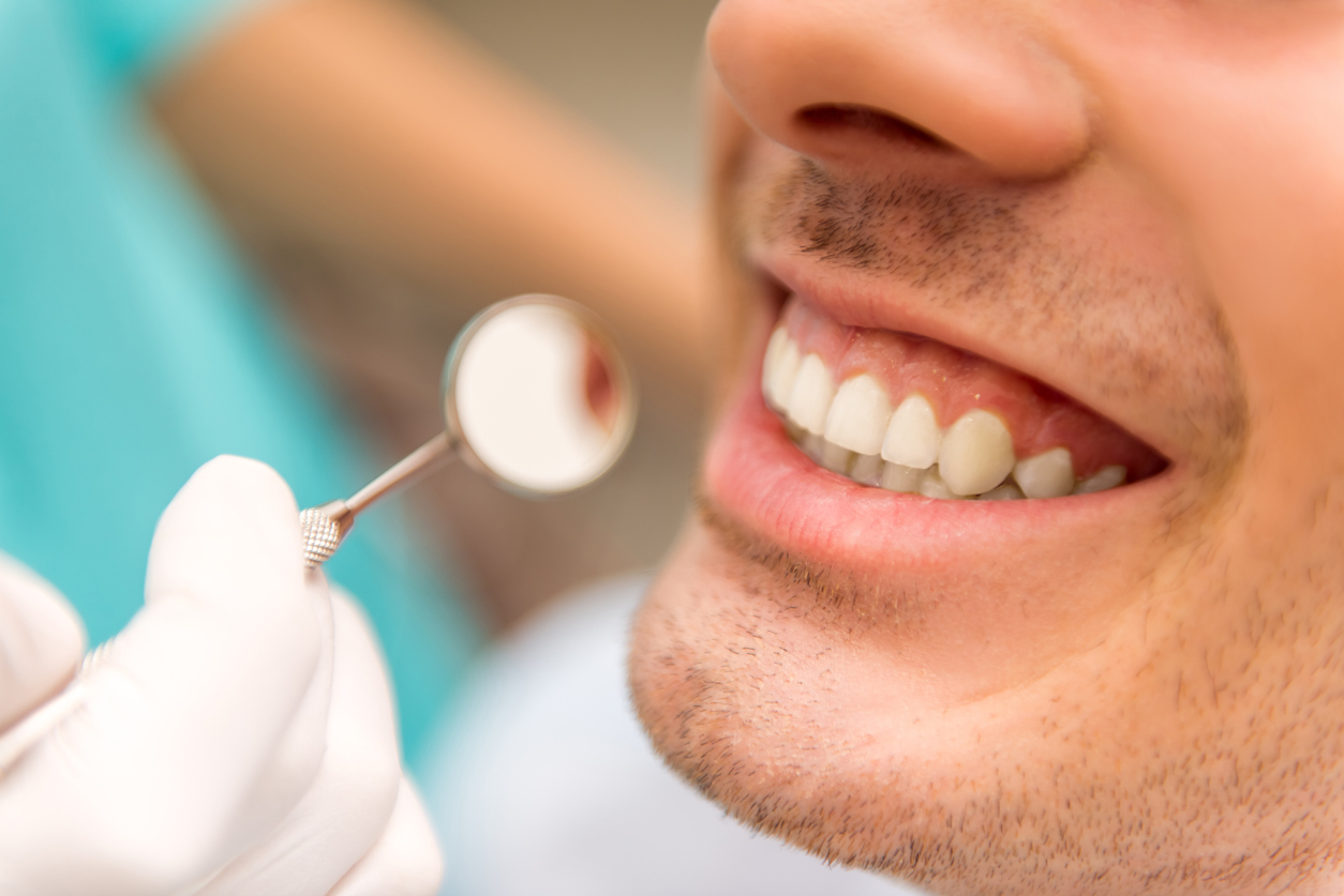 Is Your Smile Due for a Checkup? Here’s How Often You Should Have a Dental Cleaning